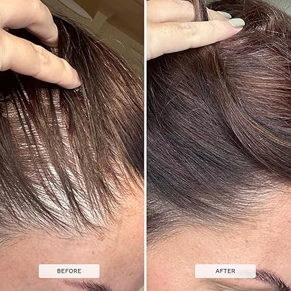HAIR BURST Biotin Gummies for Hair Growth .